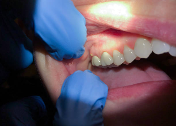 Best Weekend Emergency Dentist in St John, MO